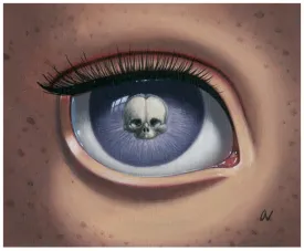Ana Bagayan - "Skeleton Eye (purple)"